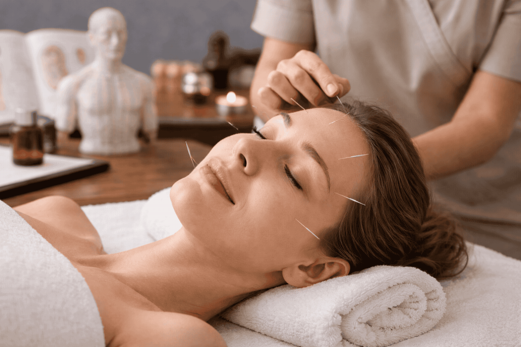 Séance d'acupuncture relaxante en clinic